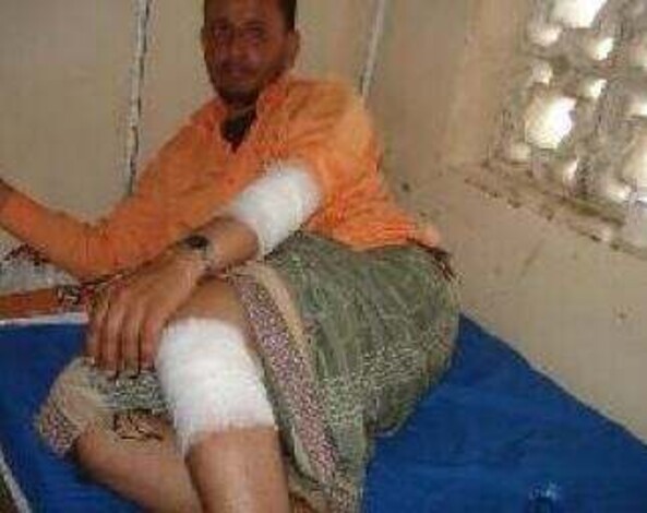 حراسة السجن المركزي بإب تعتدي بالضرب على مراسل "عدن الغد" أنيس منصور