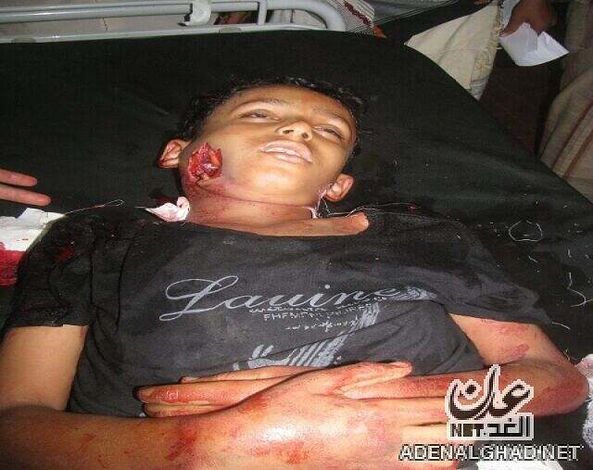 عاجل :مقتل طفل وإصابة امرأة برصاص الجيش اليمني بضواحي حوطة لحج (( صور))