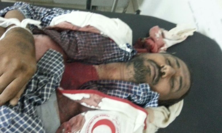 القوات الموالية للحوثيين ترتكب جريمة مروعة بحق طواقم طبية (مصور)