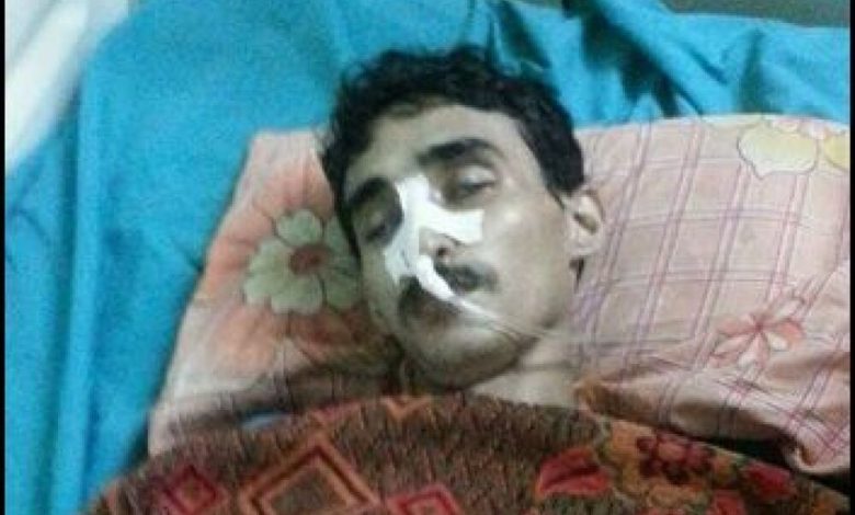 وفاة الجريح منصور قائد عقب ساعات من التوجيه بنقله للعلاج في الخارج