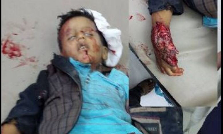 عاجل: استشهاد 4 اطفال بقصف ميليشيا الحوثي لحي الجحميلة بتعز
