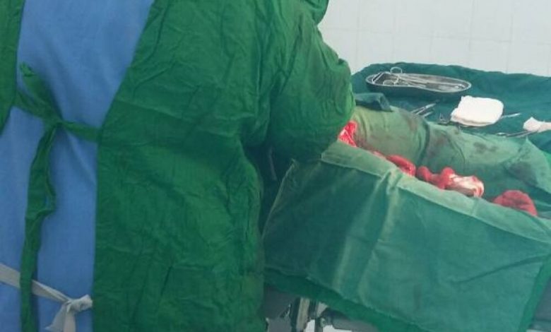 البعثة الطبية الاوزبكية بمستشفى غيل بن يمين تجري عملية قيصرية لأم أنجبت ثلاثة توأم بصحة جيدة