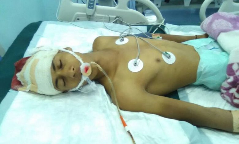 إصابة شقيق أحد قيادات المقاومة الجنوبية بجبهة الساحل بالتحيتا
