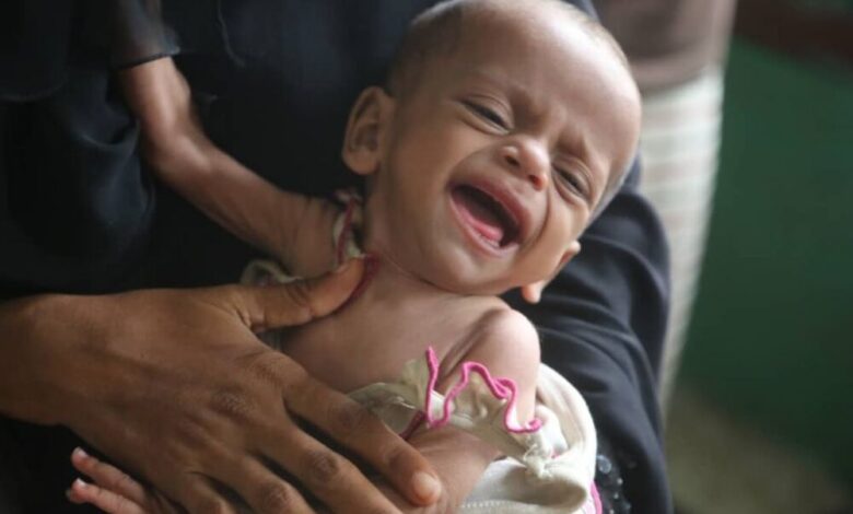 اليونيسيف:أكثر من 22مليون يمني بحاجة لمساعدات