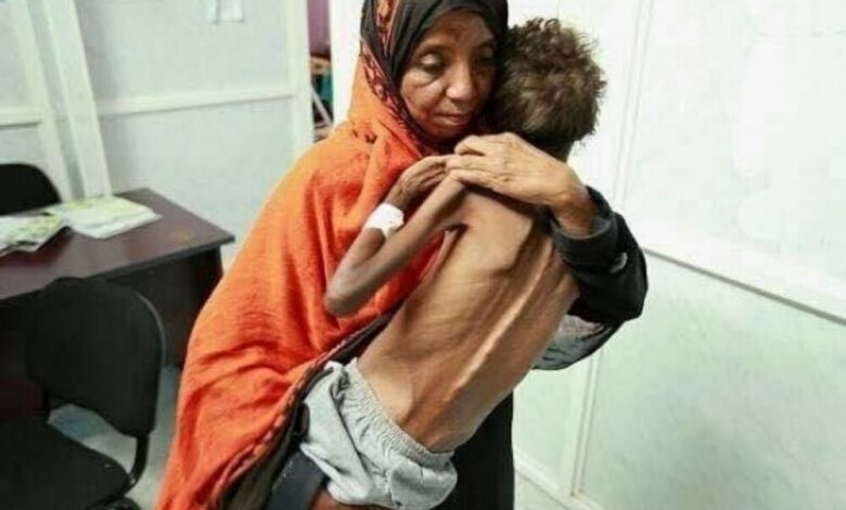 منظمة دولية: مخزون الطعام في اليمن قد ينفد خلال شهرين