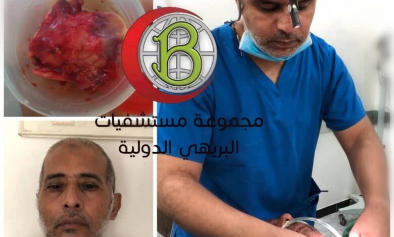 نجاح  فريق طبي  ’’بجراحة نادرة في إزالة ورم سرطاني  من حنجرة مريض يعاني من بحة صوت في مستشفى البريهي - عدن