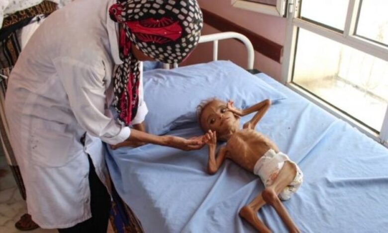 ليز غراندي:الجوع يهدد 13مليون في اليمن