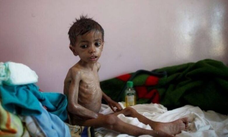 تحذير أممي لاكبر مجاعة في العالم تتعرض لها اليمن