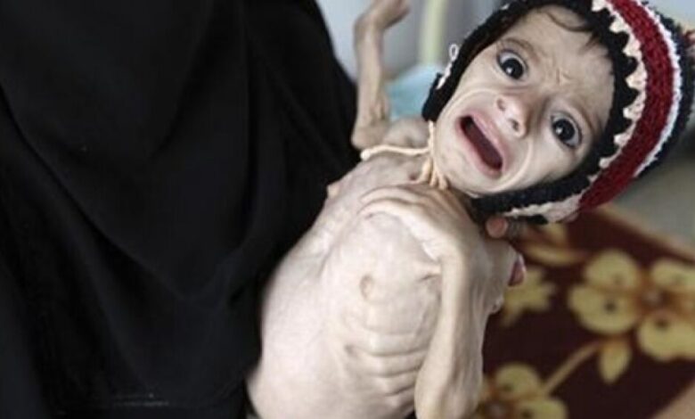 منظمة بريطانية: وفاة 85 ألف طفل يمني بسبب الجوع