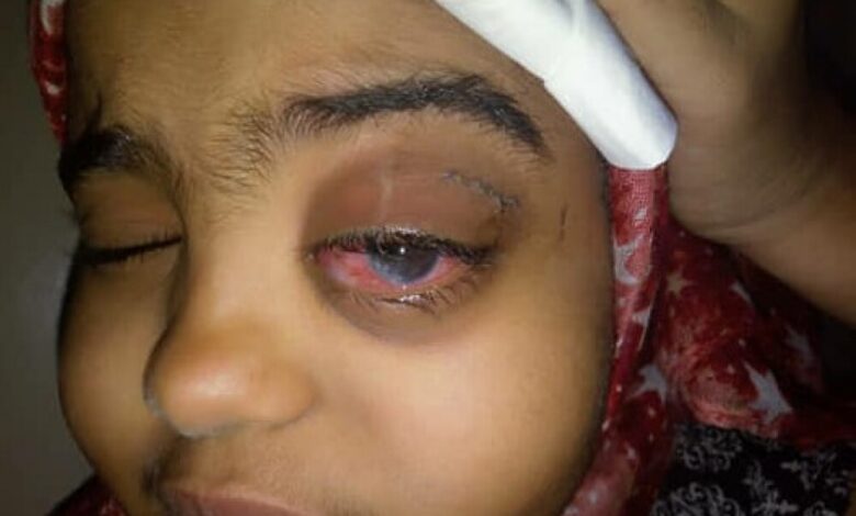 أسرة طفلة مُصابة بورم خبيث تناشد الهلال الأحمر الإماراتي مساعدتها