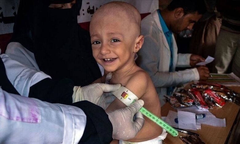 الصحة العالمية: علاج مرضى الثلاسيميا باليمن "معجزة نادرة"