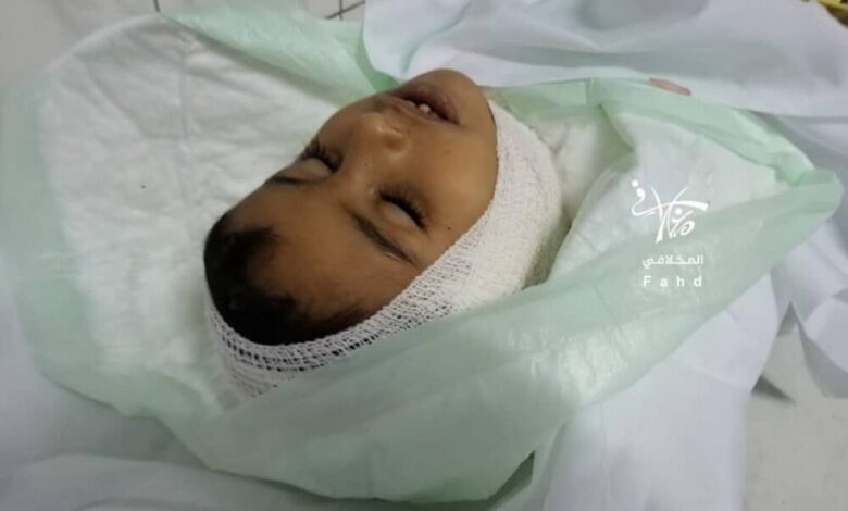 استشهاد طفل بقذيفة هاون أطلقتها مليشيا الحوثي على حي سكن بمدينة تعز
