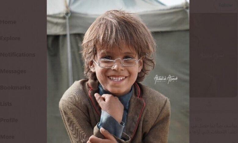 جديد النظارة الحديدية والطفل اليمني.. الصورة تفوز