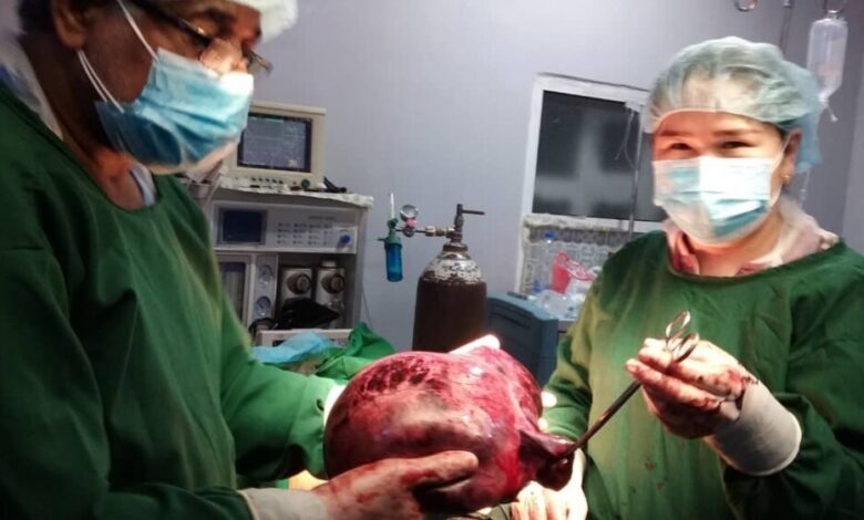 البيضاء: فريق جراحي ينجح في إستئصال كيس دموي يزن 4 كجم من بطن إمرأة حامل