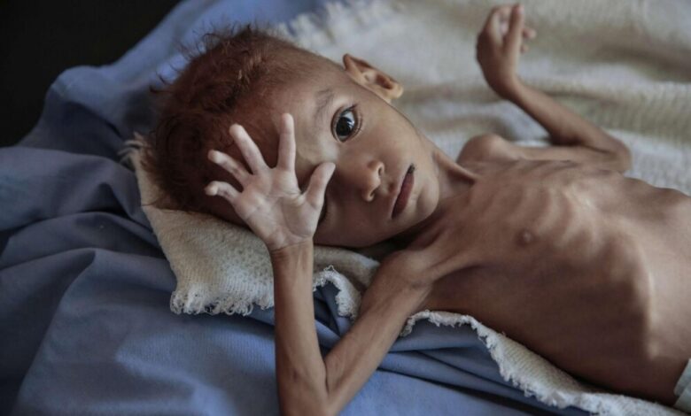 برنامج الأغذية العالمي.. اليمن على حافة أزمة مع قرب نفاد احتياطي النقد الأجنبي