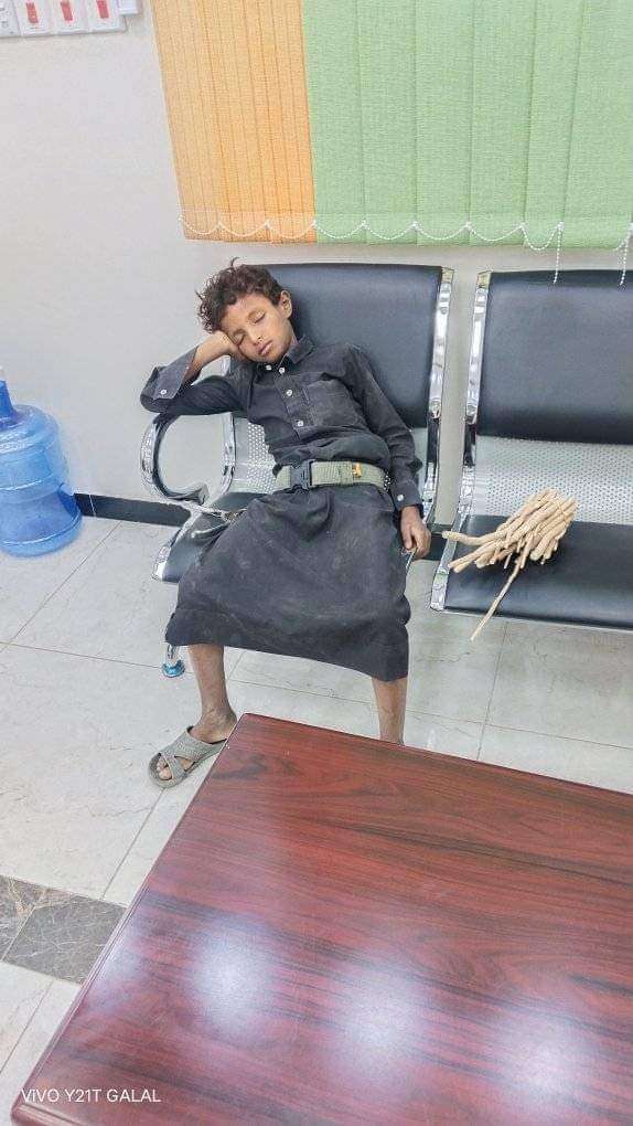 صورة اليوم في اليمن .. طفل بائع المساويك المُتعب