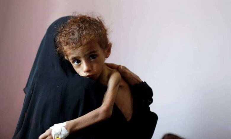 (تقرير)كارثة تهدد حياة 14 مليون انسان، اليمن.. على شفا المجاعة فهل يتحرك العالم لإنقاده؟