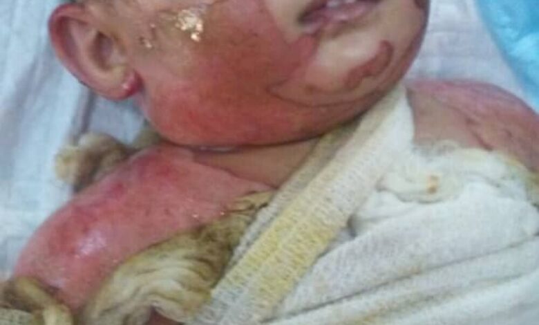 القصة الكاملة عن وفاة طفل عدن "شلال"الذي ودع الحياة بسبب الإهمال الطبي