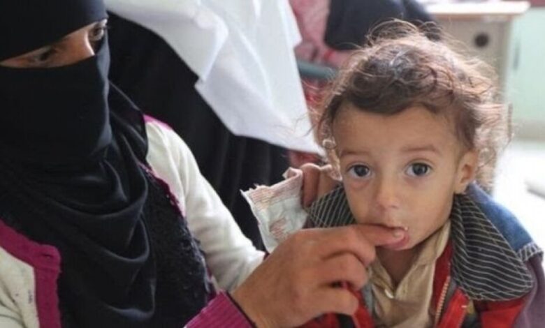 يونيسف نصف مليون طفل يمني مهددون بالموت بسبب سوء التغذية