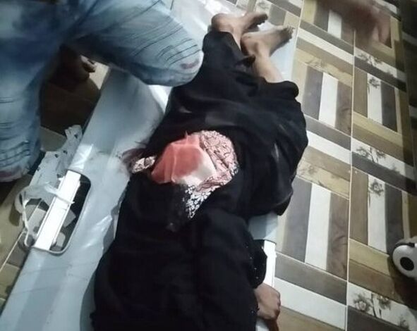 إصابة امرأة بنيران المليشيات الحوثية في مدينة حيس