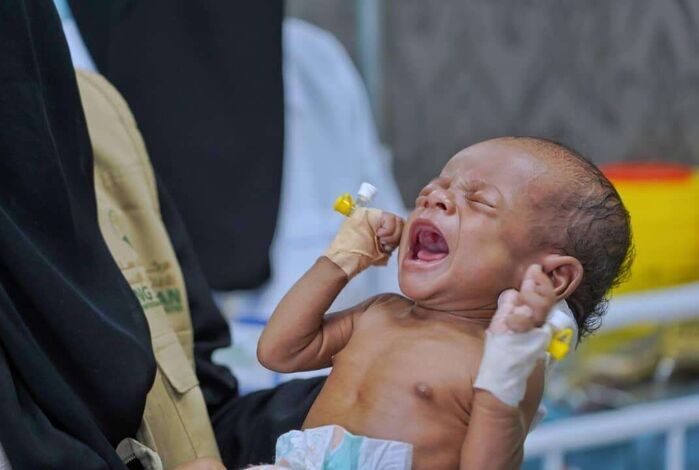 مشروع دعم التغذية للأطفال والأمهات الحوامل والمرضعات في اليمن يقدم خدماته ل 23.775 مستفيدا خلال شهر مايو