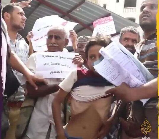 عرّى جسد ابنه ليكشف المأساة.. صرخة أب جريح تلخص حال أطفال اليمن (فيديو)