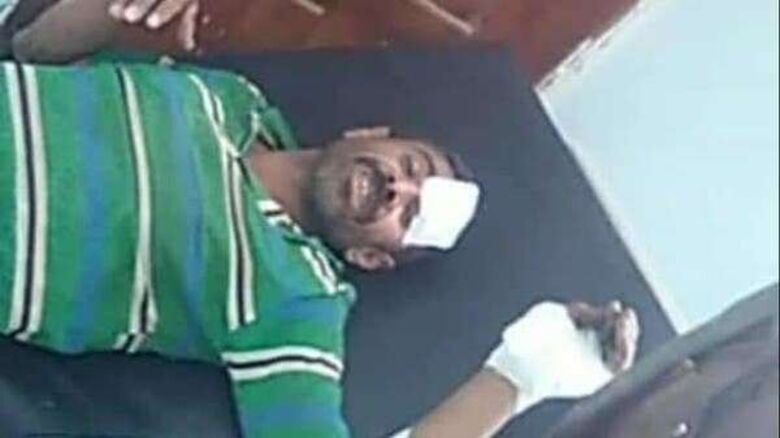 إصابة 6 مدنيين بينهم أطفال بانفجار ألغام حوثية في محافظتي مأرب والجوف