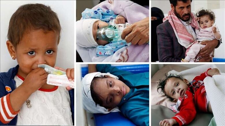 اليمن.. شبح المجاعة يخنق براءة الأطفال (تقرير)