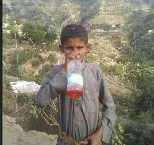 ربما تعد الأولى من نوعها ..طفل يمني يعيش على رائحة البترول