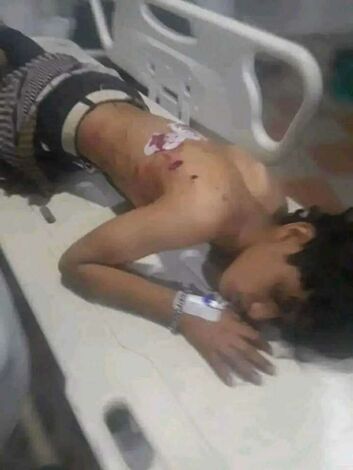 بعد يوم من تشييع طفل قتلته المليشيات.. مسلح حوثي يصيب طفل آخر شمال إب