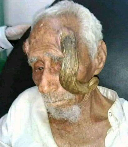 وفاة المعمر اليمني "ذو القرنين" عن عمر بلغ 140 عاماً